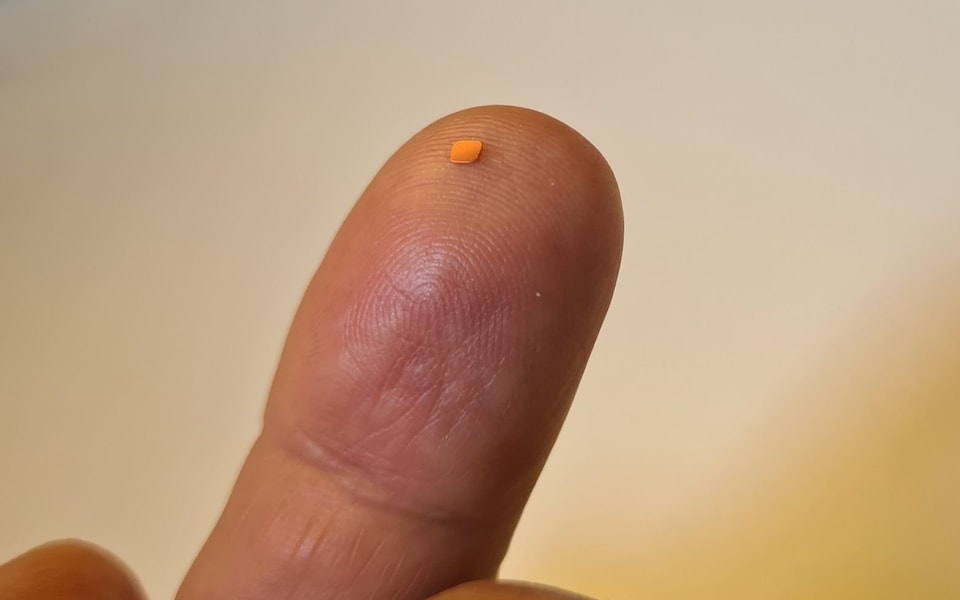 Con chip được cấy ghép vào mắt người Quá trình cấy chip Prima vào mắt